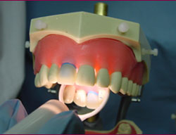 Lighted Mouth Mirror